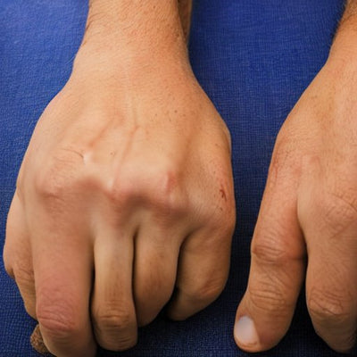 What Happens When You Crack Your Knuckles